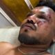 injuried survivor