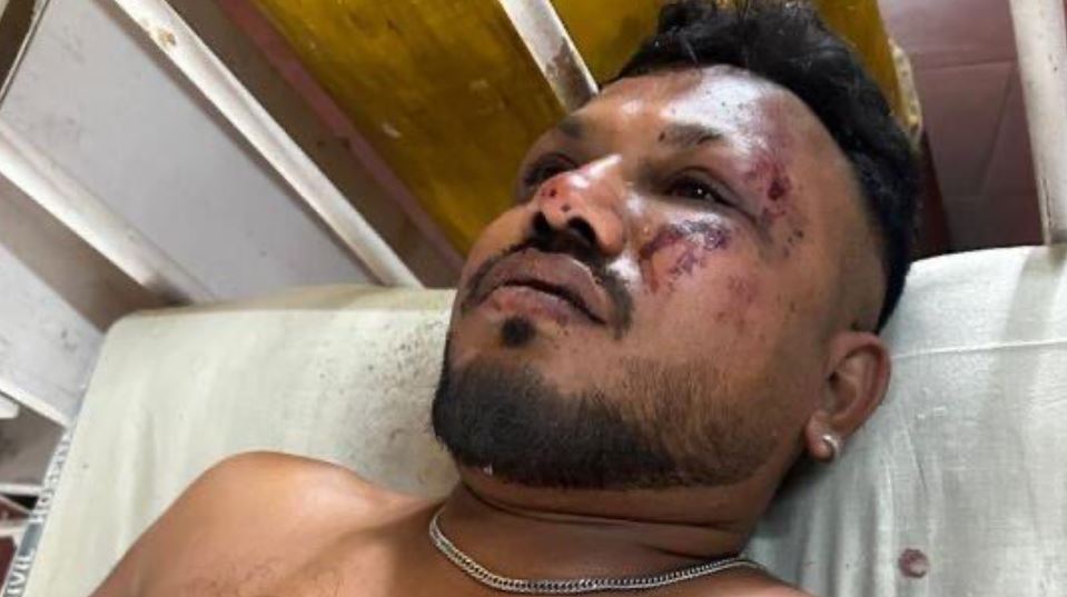 injuried survivor