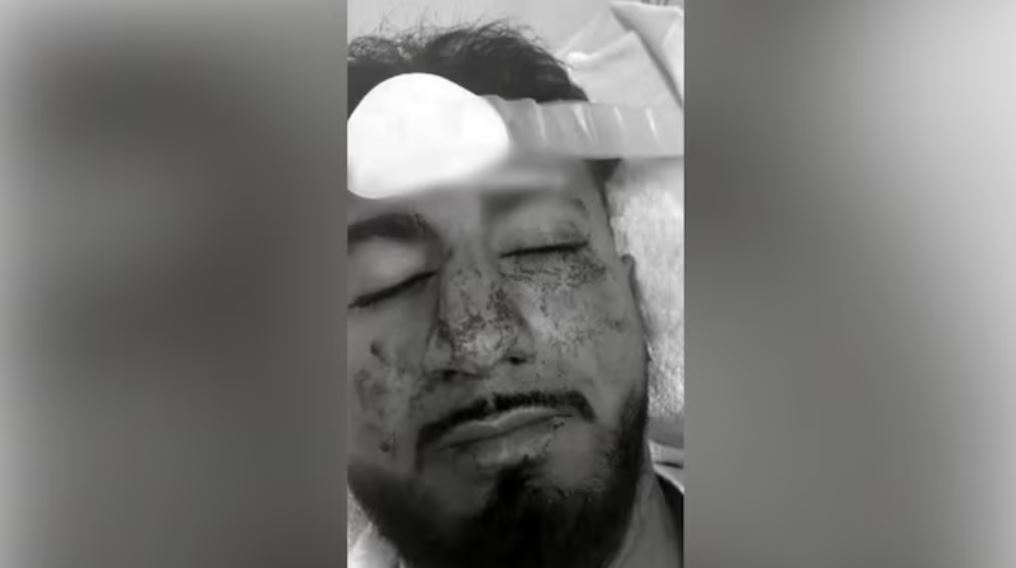 indian attacked