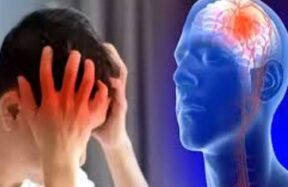brain stroke