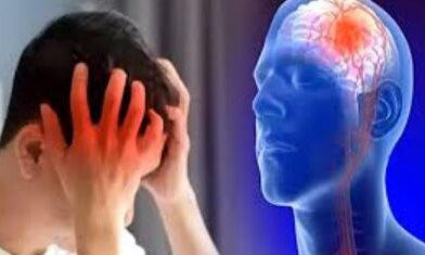 brain stroke